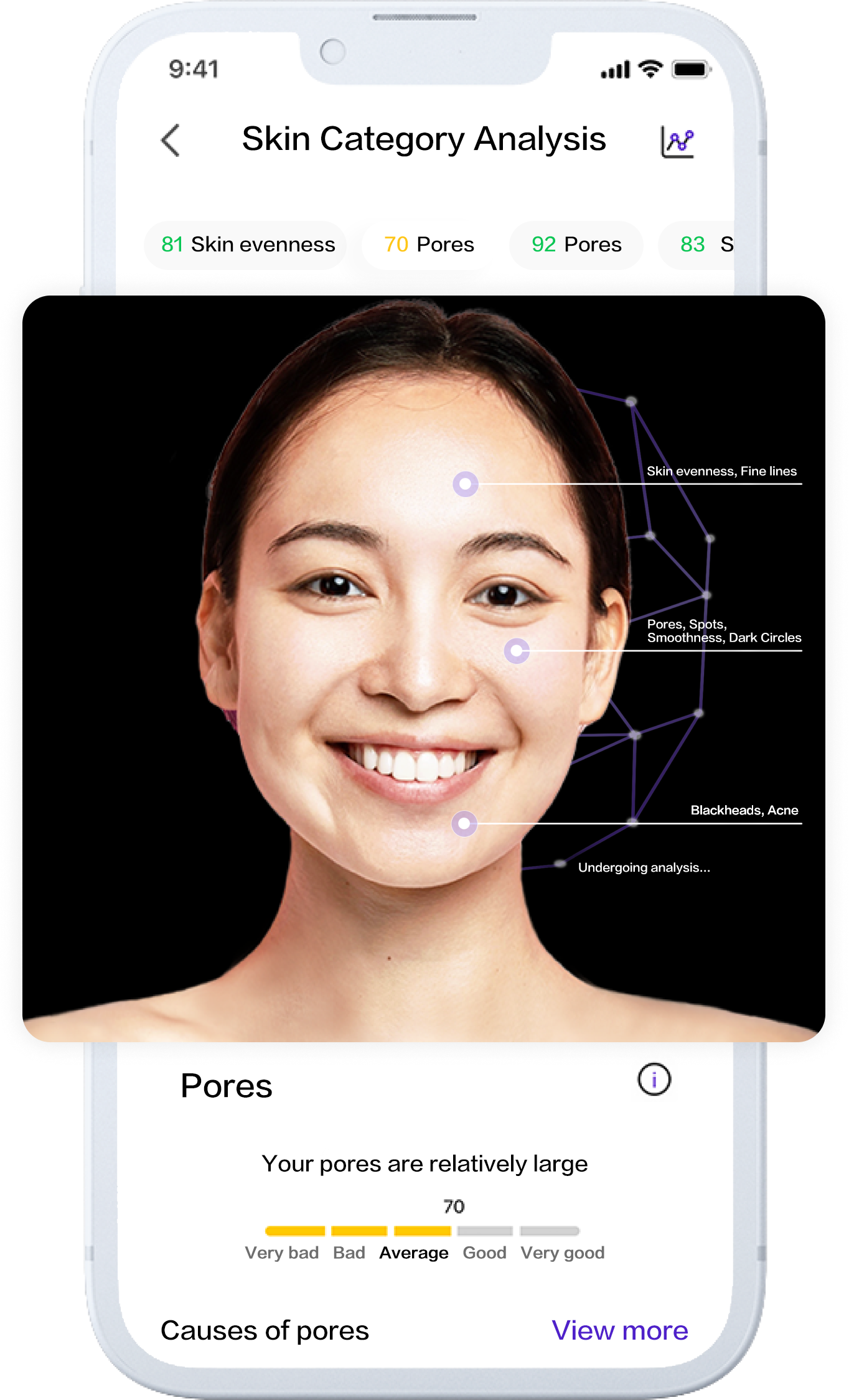 AI Skin Analysis Categories