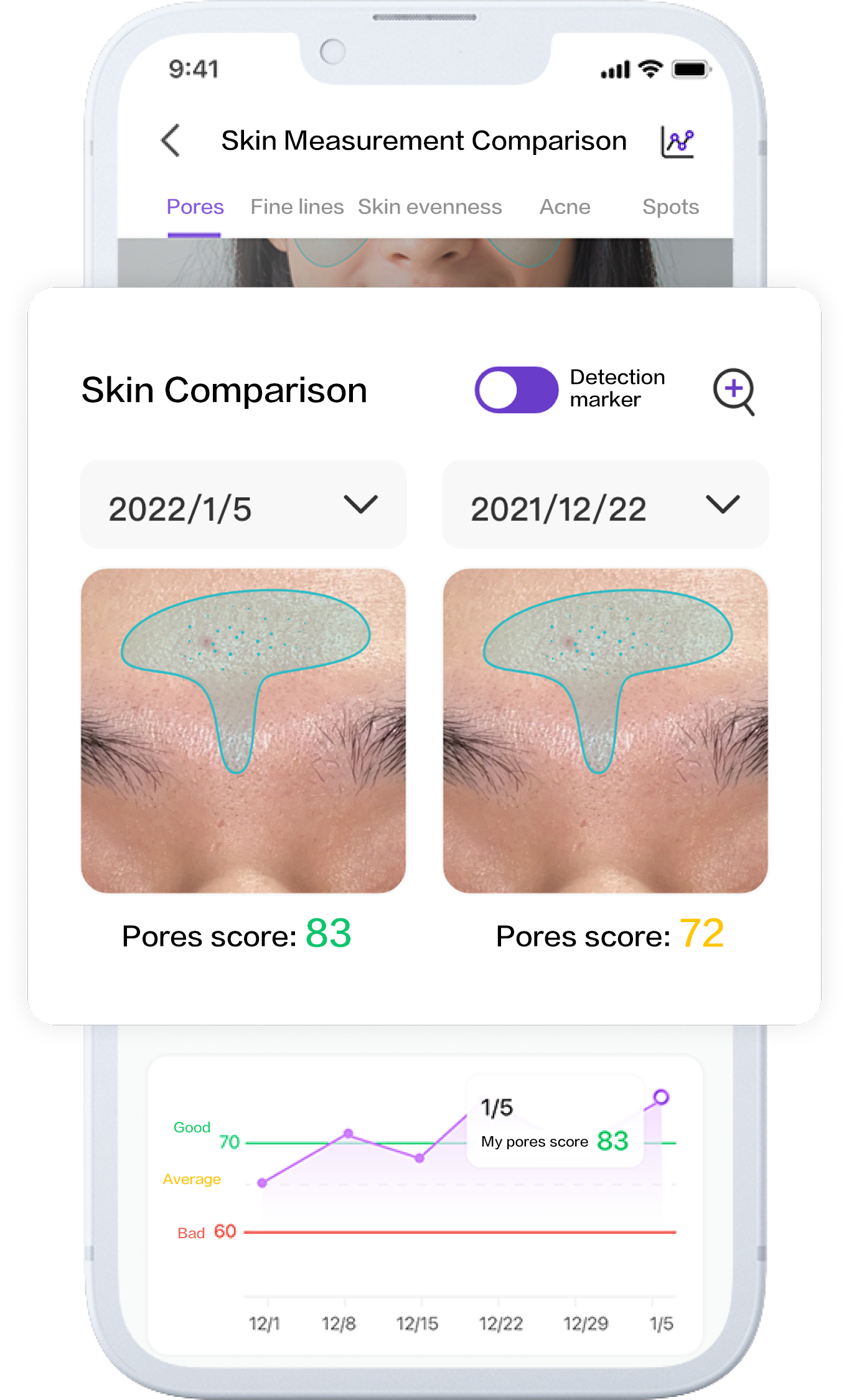 Compare Your Skin Measurement Results